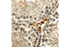 Immunohistochemistry (IHC) image for anti-Meiosis Expressed Gene 1 Homolog (MEIG1) (C-Term) antibody (ABIN1030515) (MEIG1 抗体  (C-Term))