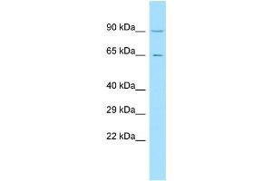WB Suggested Anti-C11orf2 Antibody Titration: 1. (VPS51 抗体  (C-Term))