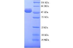 SDS-PAGE (SDS) image for Hyaluronidase-1 (HYAL1) (AA 22-435) protein (His tag) (ABIN5714342)