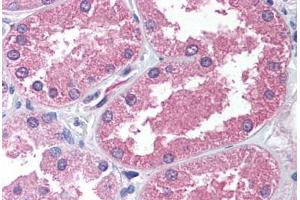 Human Kidney (formalin-fixed, paraffin-embedded) stained with AADAT antibody ABIN239800 at 2. (AADAT 抗体  (N-Term))