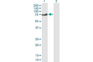 Western Blotting (WB) image for anti-Lymphocyte Cytosolic Protein 2 (SH2 Domain Containing Leukocyte Protein of 76kDa) (LCP2) (AA 1-533) antibody (ABIN517456)