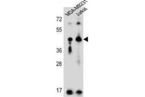Western Blotting (WB) image for anti-Killer Cell Immunoglobulin-Like Receptor, Two Domains, Long Cytoplasmic Tail, 2 (KIR2DL2) antibody (ABIN3002433) (KIR2DL2 抗体)