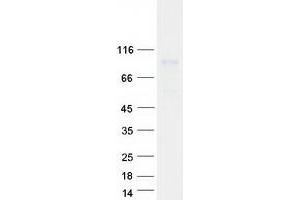 Western Blotting (WB) image for Procollagen-Lysine,2-Oxoglutarate 5-Dioxygenase 1 (PLOD1) protein (Myc-DYKDDDDK Tag) (ABIN2729187)