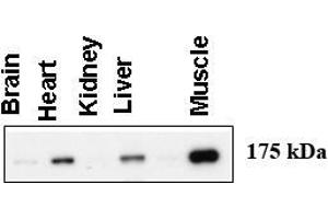 Western blot using anti-AGL antibody at 1:1000 dilution. (AGL 抗体  (C-Term))