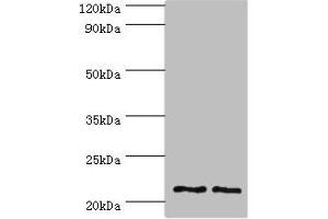 Western blot All lanes: DNAL1 antibody at 4 μg/mL Lane 1: Hela whole cell lysate Lane 2: HepG2 whole cell lysate Secondary Goat polyclonal to rabbit IgG at 1/10000 dilution Predicted band size: 22, 9, 18 kDa Observed band size: 22 kDa (DNAL1 抗体  (AA 41-190))