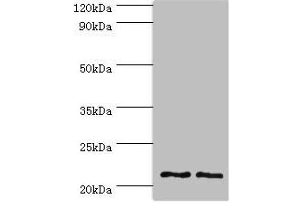 DNAL1 抗体  (AA 41-190)