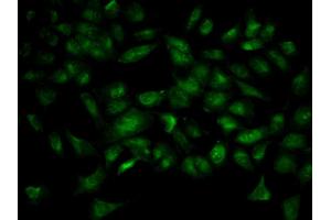 Immunofluorescence analysis of HeLa cell using YWHAB antibody. (YWHAB 抗体  (AA 1-246))