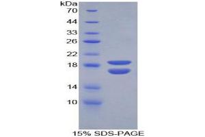 SDS-PAGE analysis of Mouse PHPT1 Protein. (PHPT1 蛋白)