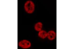 ABIN6276970 staining HepG2? (POLI 抗体  (N-Term))