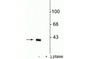 Western blot of rat striatal lysate showing specific immunolabeling of the ~32 kDa DARPP-32 phosphorylated at Thr75 in the first lane (-). (DARPP32 抗体  (pThr75))