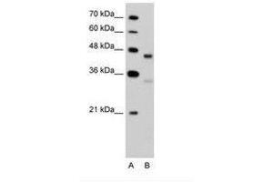 Image no. 2 for anti-G Protein-Coupled Receptor 161 (GPR161) (C-Term) antibody (ABIN203448) (GPR161 抗体  (C-Term))