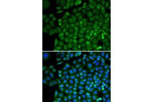 Immunofluorescence analysis of HeLa cells using SELENBP1 antibody (ABIN3021766, ABIN3021767, ABIN3021768 and ABIN1513508). (SELENBP1 抗体  (AA 243-472))