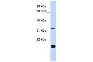 FST antibody used at 1 ug/ml to detect target protein. (Follistatin 抗体  (Middle Region))