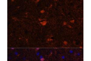 Immunofluorescence analysis of Rat brain using S100B Polyclonal Antibody at dilution of 1:100. (S100B 抗体)
