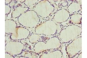Immunohistochemistry of paraffin-embedded human thyroid tissue using ABIN7142596 at dilution of 1:100 (ALAS2 抗体  (AA 50-587))