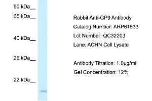 Western Blotting (WB) image for anti-Glycoprotein IX (Platelet) (GP9) (Middle Region) antibody (ABIN786439) (CD42a 抗体  (Middle Region))