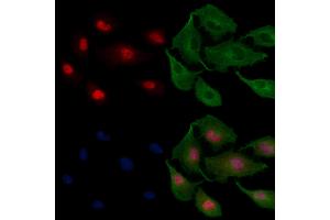 ABIN6258128 and ABIN6275417 staining  cells by IF/ICC. (DYRK3 抗体  (C-Term))