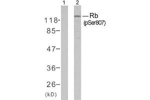 Western blot analysis of extracts from K562 cells untreated or treated with 10% serum after 48 hours of starvation, using Rb (phospho-Ser807) antibody (E011131). (Retinoblastoma 1 抗体  (pSer807))