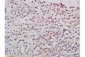 Formalin-fixed and paraffin embedded rat brain tissue labeled with Anti-PATZ1 Polyclonal Antibody, Unconjugated (ABIN759836) at 1:200 followed by conjugation to the secondary antibody and DAB staining (PATZ1 抗体  (AA 351-450))