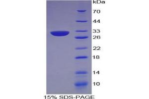 SDS-PAGE analysis of Human Centromere Protein I Protein. (CENPI 蛋白)