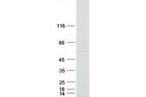 Western Blotting (WB) image for rho GTPase Activating Protein 15 (ARHGAP15) protein (Myc-DYKDDDDK Tag) (ABIN2714872)