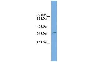 WB Suggested Anti-C2orf25 Antibody Titration: 0. (MMADHC 抗体  (N-Term))