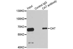 Immunoprecipitation analysis of 100ug extracts of HepG2 cells using 3ug CAT antibody. (Catalase 抗体)