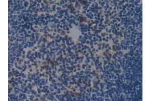 Detection of COL1a2 in Mouse Spleen Tissue using Polyclonal Antibody to Collagen Type I Alpha 2 (COL1a2) (COL1A2 抗体  (AA 1109-1372))