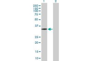 Western Blot analysis of MRPL1 expression in transfected 293T cell line by MRPL1 MaxPab polyclonal antibody. (MRPL1 抗体  (AA 1-303))
