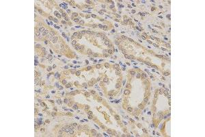 Immunohistochemistry of paraffin-embedded human kidney using BCL2L1 antibody at dilution of 1:200 (x400 lens) (BCL2L1 抗体)