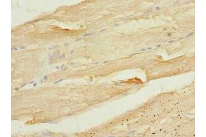 Immunohistochemistry of paraffin-embedded human skeletal muscle tissue using ABIN7146597 at dilution of 1:100 (CALU 抗体  (AA 20-315))