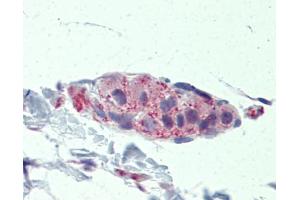 Immunohistochemistry (IHC) image for anti-Tankyrase, TRF1-Interacting Ankyrin-Related ADP-Ribose Polymerase (TNKS) (Middle Region) antibody (ABIN2778109) (TNKS 抗体  (Middle Region))