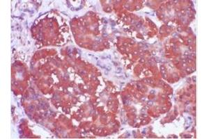 Immunohistochemistry (IHC) image for anti-Trefoil Factor 1 (TFF1) (AA 57-84), (C-Term) antibody (ABIN781662) (TFF1 抗体  (C-Term))