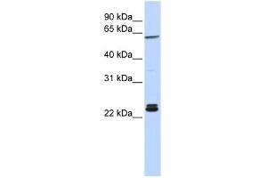 H1F0 antibody used at 1 ug/ml to detect target protein. (Histone H1 抗体  (N-Term))