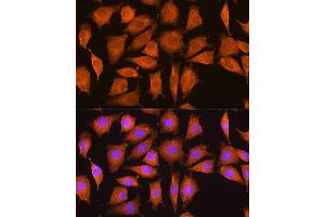 Immunofluorescence analysis of L929 cells using NCSTN Rabbit pAb (ABIN7268905) at dilution of 1:100. (Nicastrin 抗体  (AA 429-669))