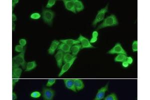 Immunofluorescence analysis of HeLa cells using SLC2A9 Polyclonal Antibody at dilution of 1:100. (SLC2A9 抗体)
