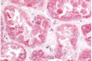 Human Kidney (formalin-fixed, paraffin-embedded) stained with ESRRG antibody ABIN213503 at 10 ug/ml followed by biotinylated goat anti-rabbit IgG secondary antibody ABIN481713, alkaline phosphatase-streptavidin and chromogen. (ESRRG 抗体  (N-Term))