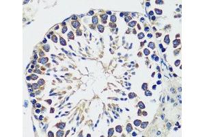 Immunohistochemistry (Paraffin-embedded Sections) (IHC (p)) image for anti-Coiled-Coil Domain Containing 124 (CCDC124) antibody (ABIN7257792)