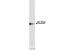 Western Blot analysis of CDX-2 in human colorectal adenocarcinoma. (CDX2 抗体)