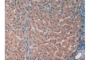 IHC-P analysis of Human Liver Tissue, with DAB staining. (GAA 抗体  (AA 595-770))