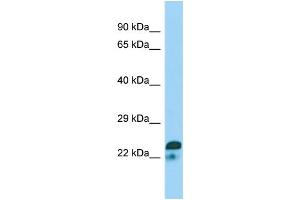 WB Suggested Anti-SPIN2A Antibody Titration: 1. (SPIN2A 抗体  (N-Term))