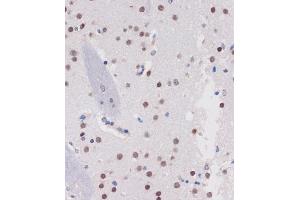 Immunohistochemistry of paraffin-embedded Mouse brain using B Rabbit pAb (ABIN7265702) at dilution of 1:100 (40x lens). (ARID1B 抗体  (AA 400-650))