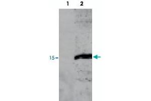 Detecting RPS19 protein in HepG2 cell homogenate. (RPS19 抗体)