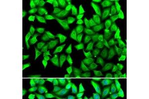 Immunofluorescence analysis of U2OS cells using VTI1B Polyclonal Antibody