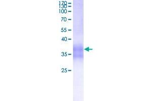 Image no. 1 for Tumor Necrosis Factor Receptor Superfamily, Member 1A (TNFRSF1A) (AA 22-211) protein (His-DYKDDDDK-Strep II Tag) (ABIN5569885)