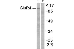 Western blot analysis of extracts from 293 cells, untreated or treated with Forskolin (40nM, 30mins), using GluR4 antibody (ABIN5976411). (Metabotropic Glutamate Receptor 4 抗体  (C-Term))