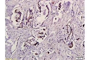 Immunohistochemistry (IHC) image for anti-Eukaryotic Translation Initiation Factor 4E Binding Protein 1 (EIF4EBP1) (pThr37), (pThr46) antibody (ABIN682978)
