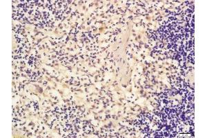 Immunohistochemistry (Paraffin-embedded Sections) (IHC (p)) image for anti-Eukaryotic Translation Initiation Factor 4E Nuclear Import Factor 1 (EIF4ENIF1) (AA 51-150) antibody (ABIN2173808)