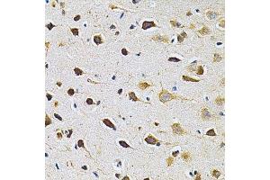 Immunohistochemistry of paraffin-embedded rat brain using ADRBK1 Antibody. (GRK2 抗体  (AA 440-689))