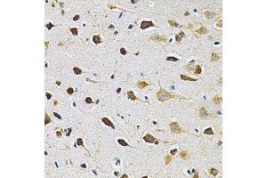 Immunohistochemistry of paraffin-embedded rat brain using ADRBK1 Antibody. (GRK2 抗体  (AA 440-689))